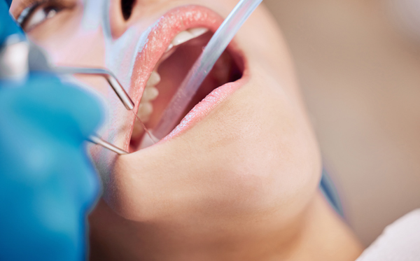 Aftercare Tips Following A Tooth Extraction